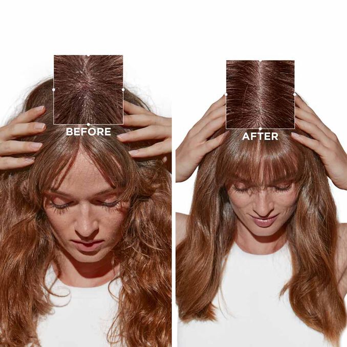 Kérastase- Micro-peeling cellulaire