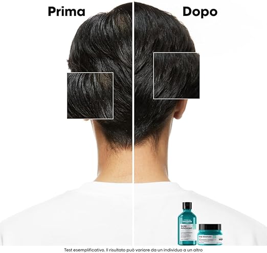 L'Oreal Professionnel- Scalp Advanced Maschera