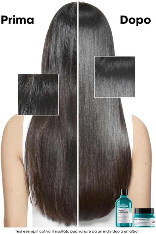 L'Oreal Professionnel- Scalp Advanced Maschera