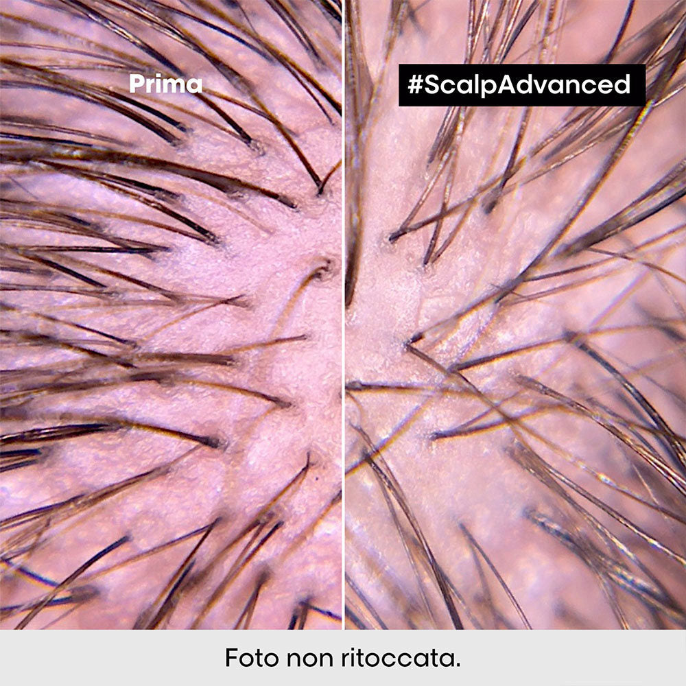 L'Oreal Professionnel Scalp Advanced Anti-Discomfort Shampoo