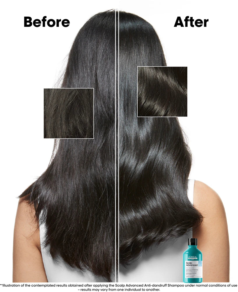 L'Oreal Professionnel- Scalp Advanced Shampoo antiforfora